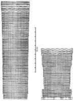 Piolenc, La Mornasse (84), inhumation, -550/-475