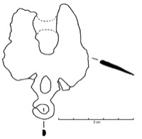 Mailhac, Grand Bassin I (11), tombe 394, -775/-725